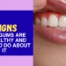 7 signs your gums are unhealthy and what to do about it